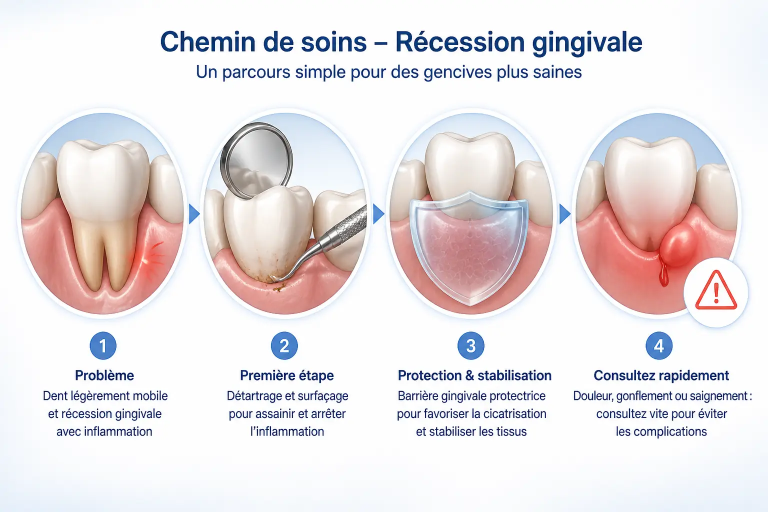 Déchaussement des dents : dent légèrement mobile, gencive rétractée, soins dentaires et alerte rapide