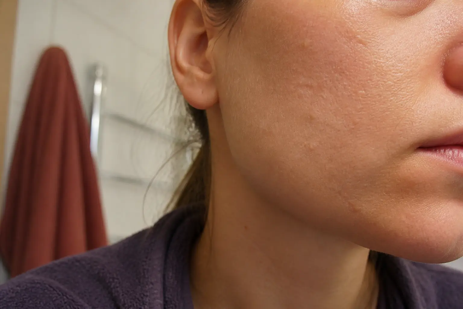 Peau visage granuleuse en gros plan sur la joue et la mâchoire, pores visibles, petites bosses et zones sèches, lumière douce de salle de bain.