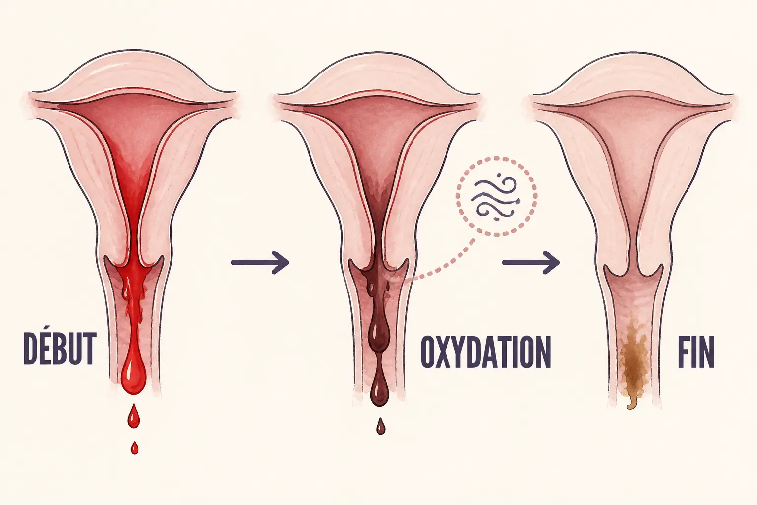 Infographie médicale des règles marrons : sang rouge au début, oxydation, puis brun en fin de cycle.