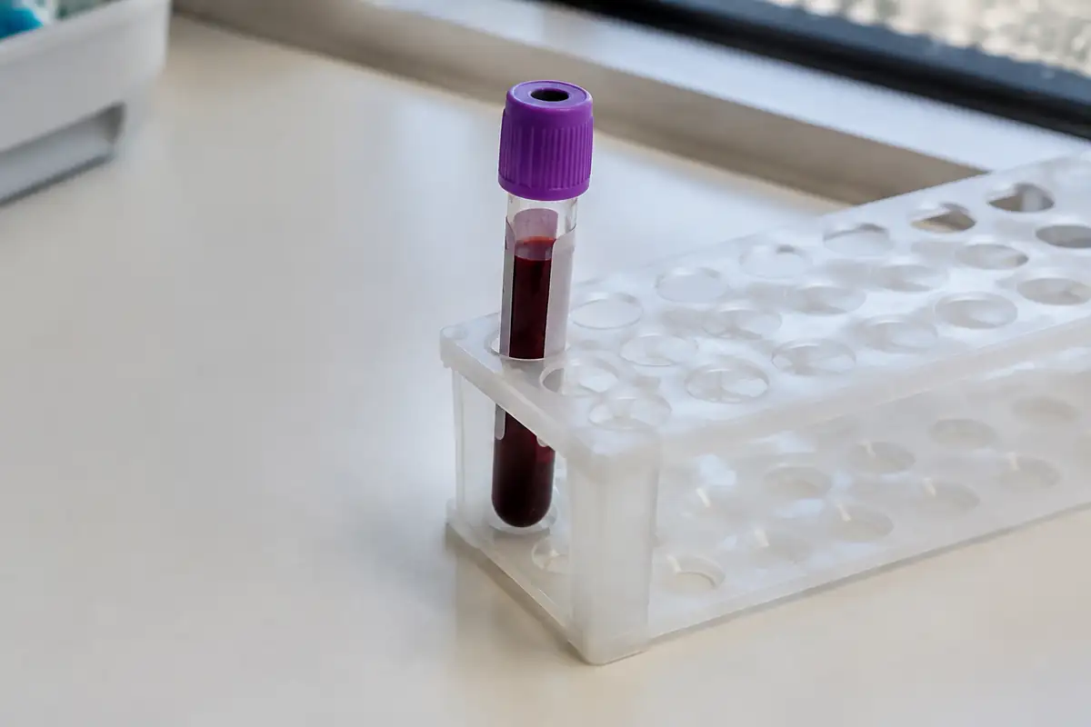 Tube de prise de sang rangé dans un support en plastique